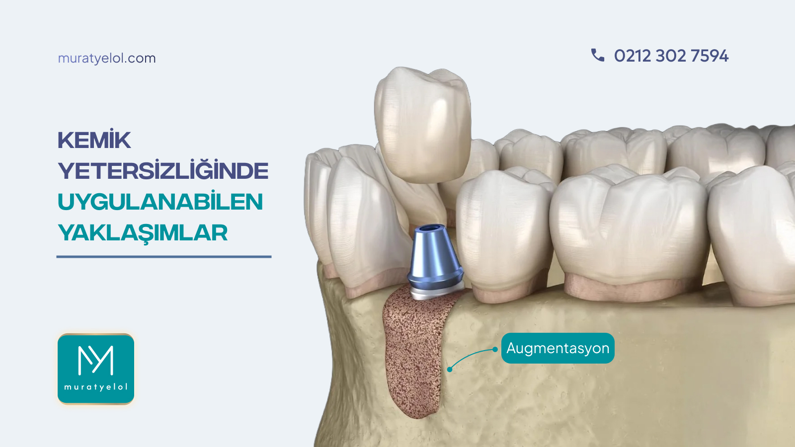"Kemik Yok" Denilen Hastalarda Gerçekten Seçenek Kalmaz mı?