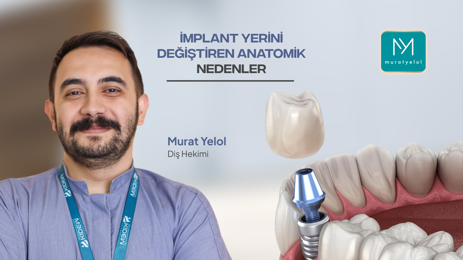 Tomografiye Göre İmplant Yeri Neden Değişebilir?
