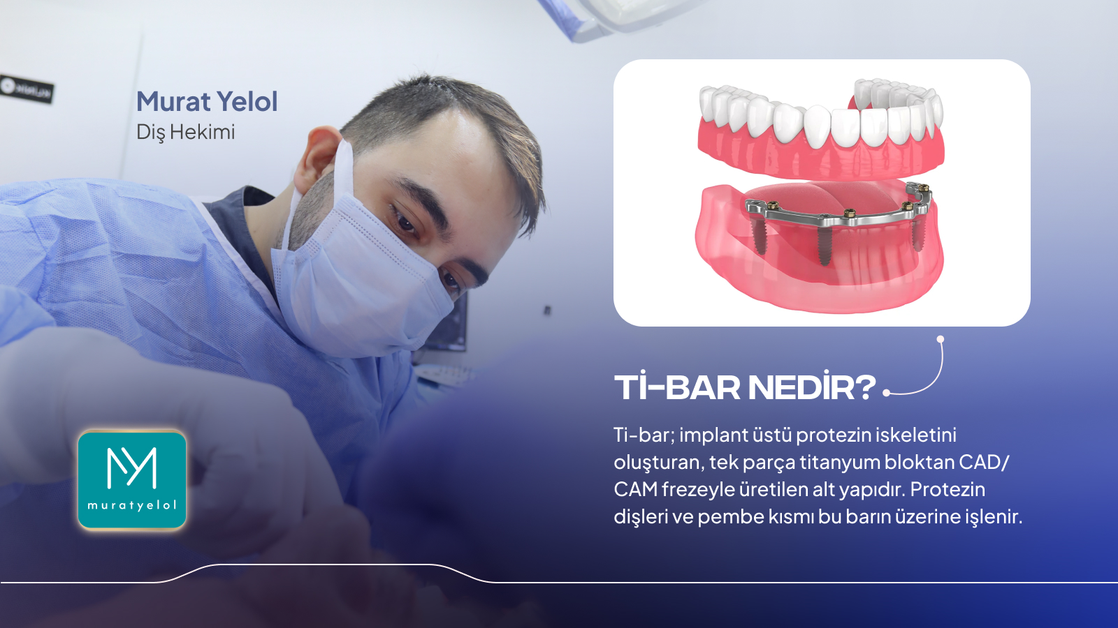 Ti-Bar Sistem Hangi Protezlerde Avantaj Sağlar?